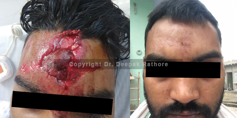 Face Injury doctor in Delhi NCR